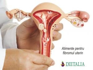 Alimente pentru fibromul uterin, recomandate de medicii nutritionisti de la Clinica Dietalia